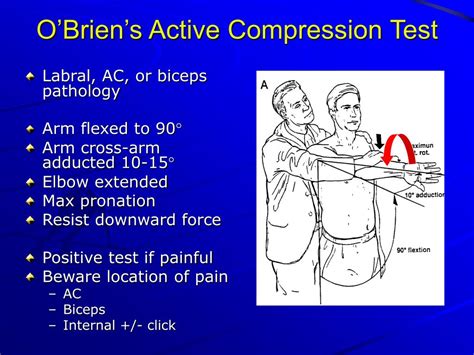 advanced tests for shoulder labral tear|speed's test vs o'brien's.